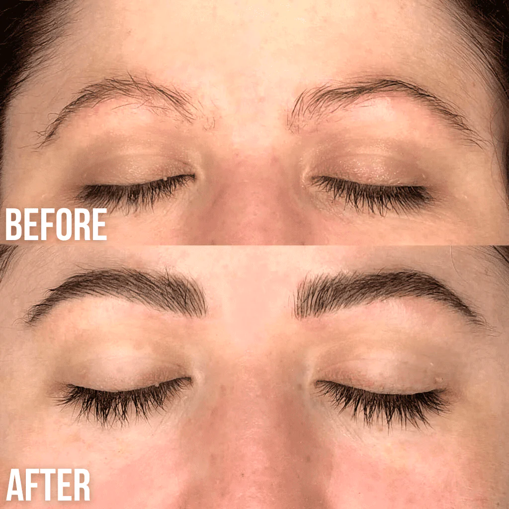 Luxe Serum Bundle Set - Image 4